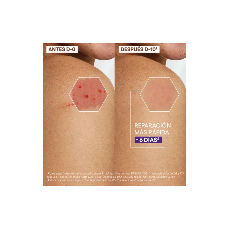 ADerma Epitheliale Ultra Repair Crema Antimarcas 40 ml