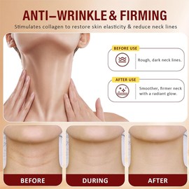 Ah-8 Firming Neck Cream, Tighten And Lift Neck Cream, Neck Firming Creams, Moisturizing, Tightening Lotions Cosmetic Skin Care Skin Repair for Women