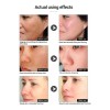 Sérum Facial Vitamina C Anti Manchas 2pzs Cuidado