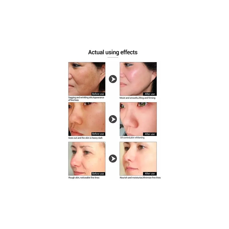 Sérum Facial Vitamina C Anti Manchas 2pzs Cuidado