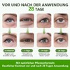 60 PCS Augenpads,Eye Pads,Eye Patches,Augenpads Gegen Augenringe,Kollagen Augenpads Gegen Augenringe