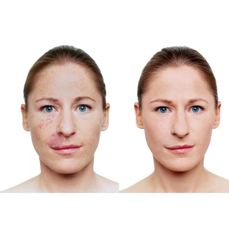 Vichy DERMABLEND Corrective Fluid Foundation 30ml. 16h. - 25 -