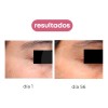Vial Regenerex Cell - Clulas Madre Silicio Hialurnico Momento de