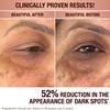 Charlotte Tilbury | Dark Spot Correcting Radiance Recovery Serum |