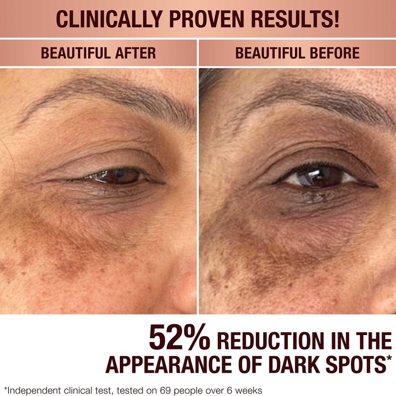 Charlotte Tilbury | Dark Spot Correcting Radiance Recovery Serum |