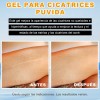 Crema Cicatricial De Minimizar Y Reducir Las Cicatrices 20g