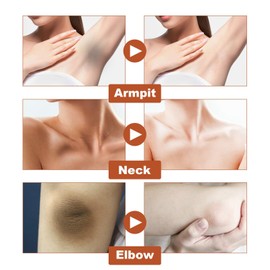 Ko/jic Acid Underarm Whitening Cream,Skin Bleaching Cream,Underarm Cream for Intimate Area,Dark Sp/ot Corrector Whitening Cream for Body,Knees,Elbows,Inner Thigh,Legs,Bikini,Non-Greasy,Smoothing