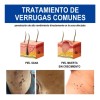 Líquido Mejorador De Verrugas Y Maíz Reva