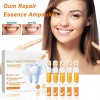 14 Piezas Gel De Cuidado Gingival 1.5ml