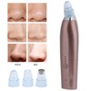 Rechargeable Electric Blackhead Removal Machine Vacuum Suction Face Pore CleanerChampagne