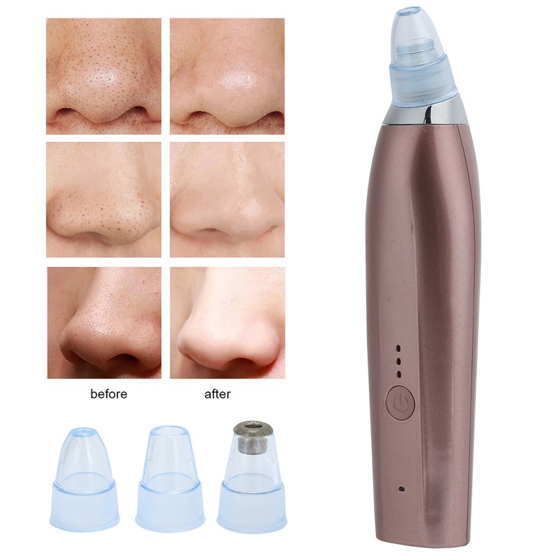 Rechargeable Electric Blackhead Removal Machine Vacuum Suction Face Pore CleanerChampagne