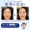 BiRyu Derma Charge Spot Cream, 3 Pieces, Viriu, Aging Care,