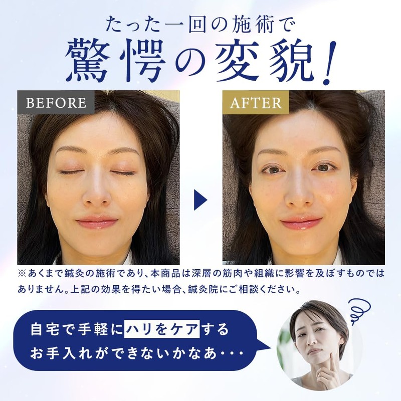 BiRyu Derma Charge Spot Cream, 3 Pieces, Viriu, Aging Care,