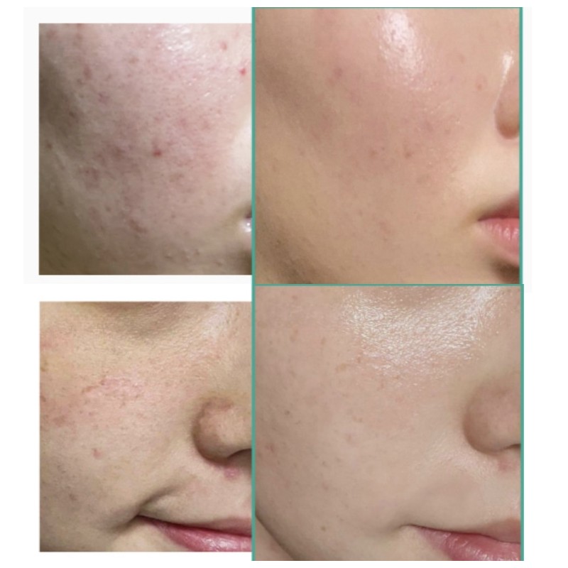 HANYUL Pure Artemisia Watery Calming Cream 55ml