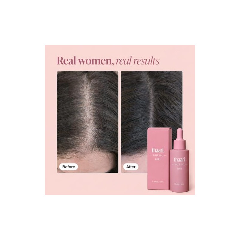 Hair Growth Oil, 1.76 fl oz (50 ml)