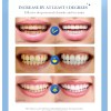 Polvo Blanqueador Kit Dientes Amarillos Manchas Efectivo