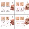 Blackhead Remover Pimple Comedone Extractor Tool Acne Kit - Treatment