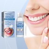 Tooth Repair Kit - Teeth Replacement Kit for Temporary Restoration