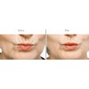 Bellahut Upper Lip/Perioral Smoothing Peptide (10ml)