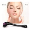 Ice Roller Rodillo Facial Roller 540 Needles Anti-edad