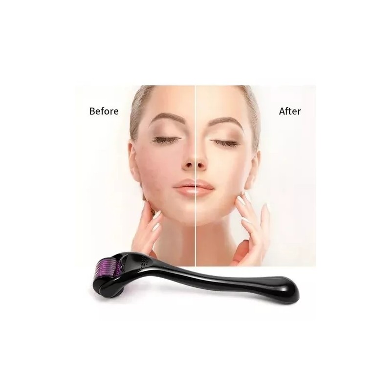 Ice Roller Rodillo Facial Roller 540 Needles Anti-edad