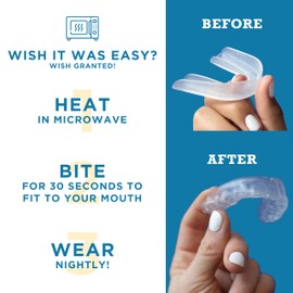 America's ToothFairy Dental Mouth Guard - Premium Protection Against Grinding & Clenching and Sports Injuries - Braces-Friendly, Made in The USA (Youth, Blue) 2 Pack