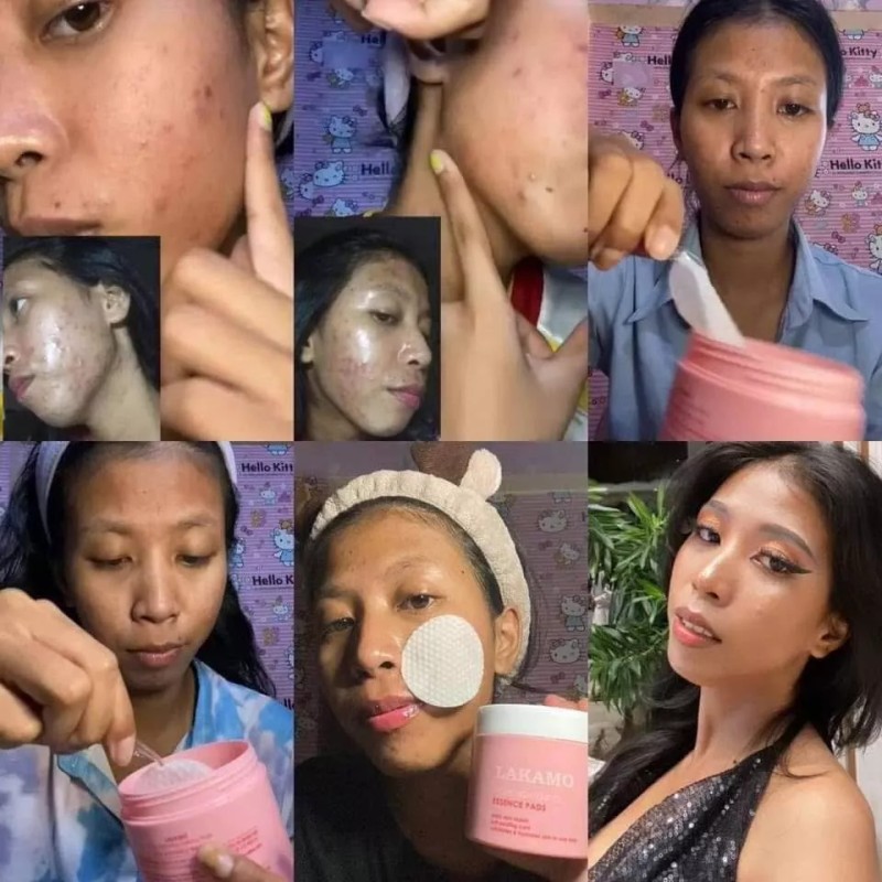 LAKAMO Pore Tightening Essence Pads សំឡីជូតមុខកូរ៉