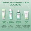 Skin1004 Kit Centella Madagascar Antiacné Tea-trica 4 Pzs