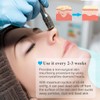 Upgraded Diamond Microdermabrasion Machine, Mcwdoit 65-68cmHg Suction Power Professional Dermabrasion