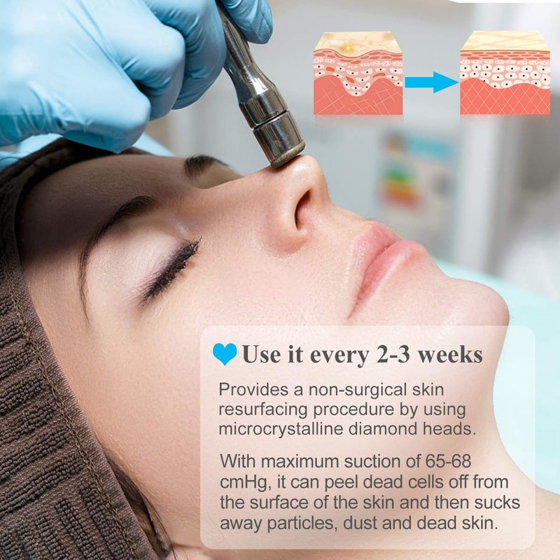Upgraded Diamond Microdermabrasion Machine, Mcwdoit 65-68cmHg Suction Power Professional Dermabrasion