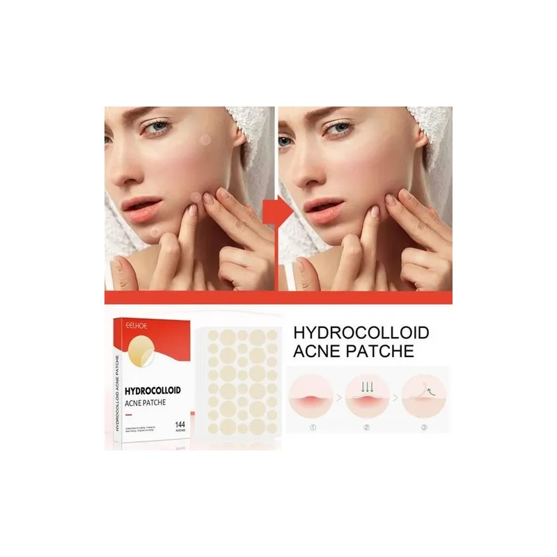 Parches Hidrocoloide Antiacné 144pzs Dia Y Noche 2 Medidas