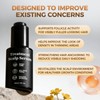 Hair Growth Serum Bundle - Plant-Based Scalp Care Formula With
