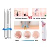 Extractor De Puntos Negros, Dispositivo De Belleza Facial Aa