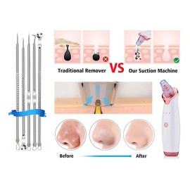 Extractor De Puntos Negros, Dispositivo De Belleza Facial Aa