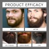 Kit Crecimiento Barba East Moon Sérum 60ml Y Rodillo