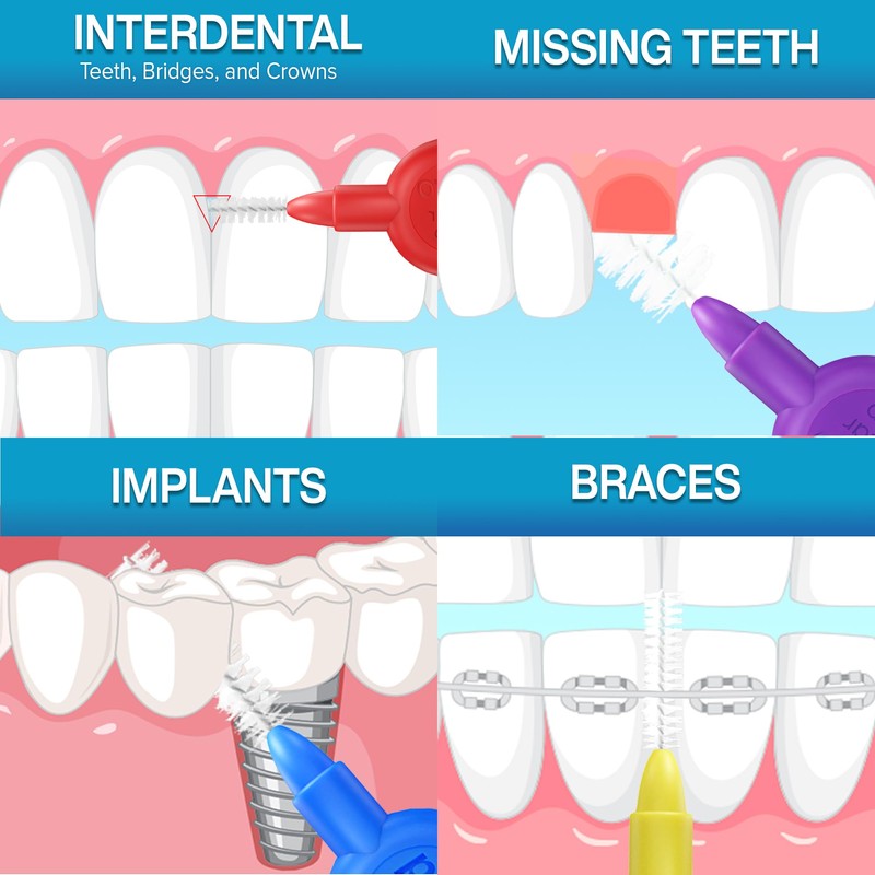 Paro Swiss 3Star-Grip Interdental Brushes – Medium, Triangular, Green, 4.5mm,