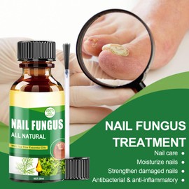 30 m Nail Care Treatment, Fingernails and Toenails for Nail Care, Brittle Nails Protection & Strengthening, Fast Acting Nail Treatment