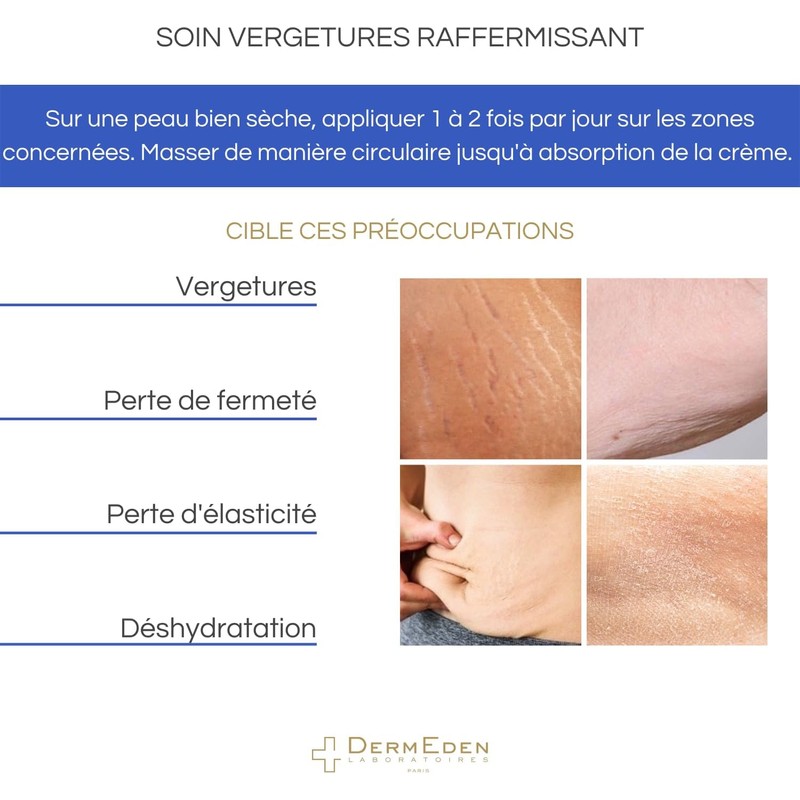 DERMEDEN Crema reafirmante para el cuidado de las marcas elásticas