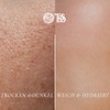 Essentials TBS Gentle Face Wash Gel, 100 ml, Sebum &