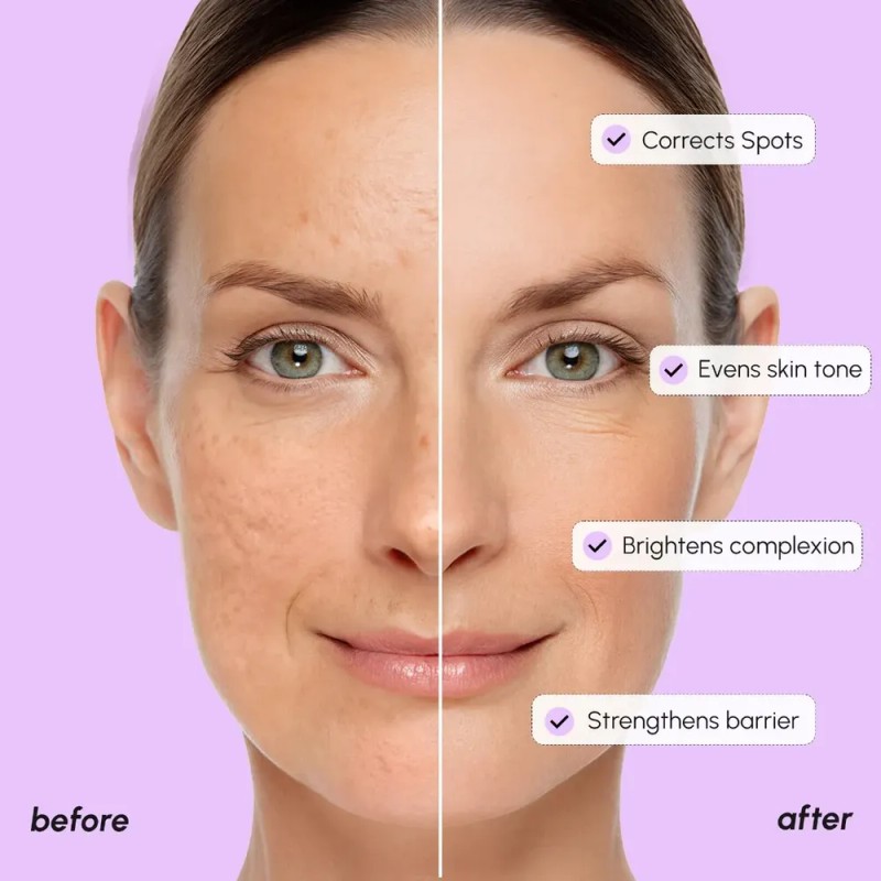 Sérum Facial Niacinamida 2.0 40ml Jumiso Todo Tipo De Piel
