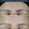 BIODERMA, Crema Facial Hidratante, Sensibio Defensive, Fortalece la Barrera Cutánea,