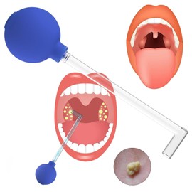 Mandelsteine Entfernen,Tonsillenstein Entferner,Mandelstein Entferner,Mandelstein Entferner,Tonsil Stone Remover,Mandelstein Entfernen Werkzeug,Gegen Mundgeruch,Oral Care