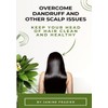  Overcome Dandruff And Other Scalp Issues: Keep Your Head Of Hair Clean And Healthy