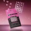 36pcs Salicylic Acid Ance Patch Skincare Large Capacity