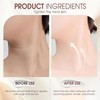 AH-8 Firming Neck Cream, 2025 New Roller Neck Firming Cream,
