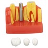 Dental Implant Teeth Model, Dental Implant Analysis Crown Bridge Model,