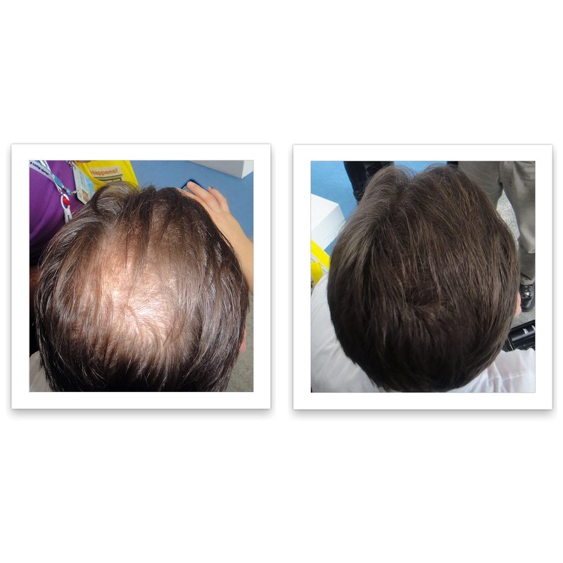 Caboki Hair Building Fiber 16G (Dark Brown)