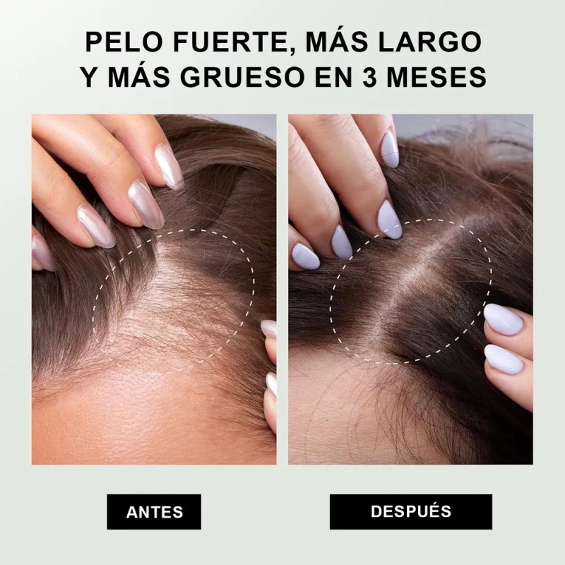 Shampoo Anticaida Con Crecimientocapilarnutre Y Protege El