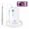 Teslong Otoscopio Digital Recargable Con Wifi Integrado. Ios Android
