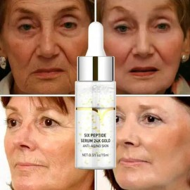 Acido Hialuronico Serum Hidratante Facial 15ml Skincare 1pz Tipo de piel Normal                                                                       